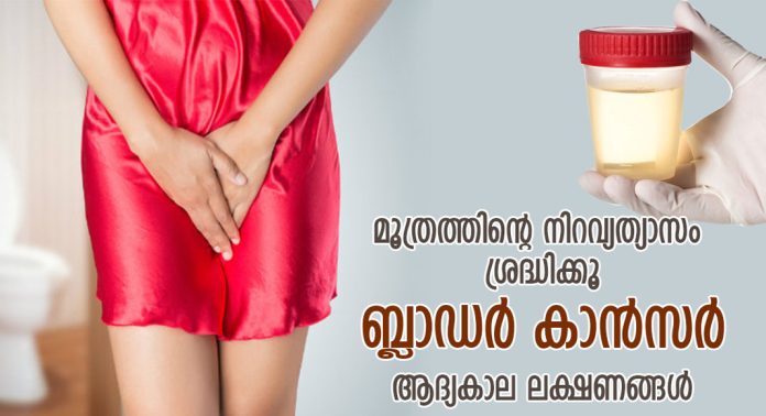 ഇടയ്ക്കിടെ മൂത്രമൊഴിക്കാന് തോന്നുന്നത് നിസാരമാക്കേണ്ട ; കാരണം ക്യാന്സറാകാം ഇടയ്ക്കിടെ മൂത്രമൊഴിക്കാന് തോന്നുന്നത് നിസാരമാക്കേണ്ട ; കാരണം ക്യാന്സറാകാം
