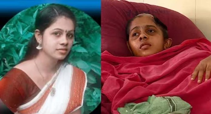 ഭര്ത്താവിന്റെ അക്രമണത്തില് തലയോട്ടി തകര്ന്നു ; യുവതി ചികിത്സക്ക് പണമില്ലാതെ ദുരിതത്തില് ഭര്ത്താവിന്റെ അക്രമണത്തില് തലയോട്ടി തകര്ന്നു ; യുവതി ചികിത്സക്ക് പണമില്ലാതെ ദുരിതത്തില്