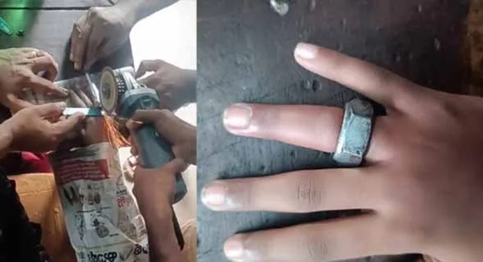 ഏഴാം ക്ലാസുകാരിയുടെ വിരലില് കുരുങ്ങിയ നട്ട് അഗ്നിശമന സേന ഉദ്യോഗസ്ഥര് മുറിച്ചു നീക്കി ഏഴാം ക്ലാസുകാരിയുടെ വിരലില് കുരുങ്ങിയ നട്ട് അഗ്നിശമന സേന ഉദ്യോഗസ്ഥര് മുറിച്ചു നീക്കി