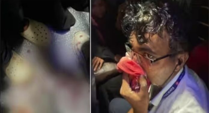വീണ്ടും ടിടിഇയ്ക്ക് ട്രെയിനില് മര്ദനം : ടിക്കറ്റെടുക്കാതെ കയറിയത് ചോദ്യം ചെയ്തപ്പോള് മൂക്കിന് ഇടിച്ച തിരുവനന്തപുരം സ്വദേശി പോലീസ് കസ്റ്റഡിയിൽ വീണ്ടും ടിടിഇയ്ക്ക് ട്രെയിനില് മര്ദനം : ടിക്കറ്റെടുക്കാതെ കയറിയത് ചോദ്യം ചെയ്തപ്പോള് മൂക്കിന് ഇടിച്ച തിരുവനന്തപുരം സ്വദേശി പോലീസ് കസ്റ്റഡിയിൽ