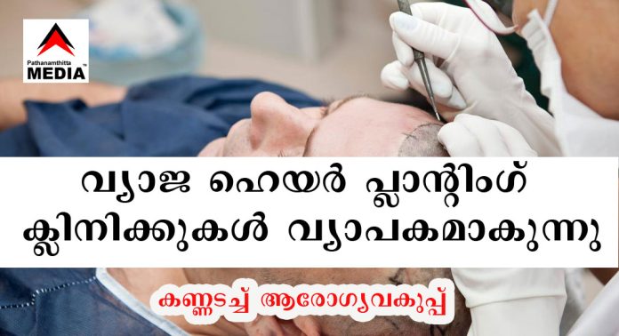 കേരളത്തില് വ്യാജ ഹെയർ പ്ലാന്റിംഗ് ക്ലിനിക്കുകള് വ്യാപകമാകുന്നു ; കണ്ണടച്ച് ആരോഗ്യവകുപ്പ് കേരളത്തില് വ്യാജ ഹെയർ പ്ലാന്റിംഗ് ക്ലിനിക്കുകള് വ്യാപകമാകുന്നു ; കണ്ണടച്ച് ആരോഗ്യവകുപ്പ്