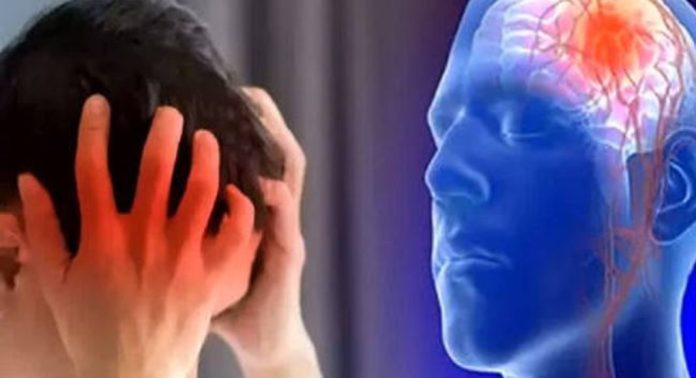 ഈ ലക്ഷണങ്ങൾ ഉണ്ടെങ്കിൽ സ്ട്രോക്കിനുള്ള സാധ്യത ഏറെ ; അറിയാം… ഈ ലക്ഷണങ്ങൾ ഉണ്ടെങ്കിൽ സ്ട്രോക്കിനുള്ള സാധ്യത ഏറെ ; അറിയാം…