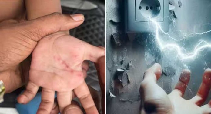വീട്ടിലെ അമിതമായ വൈദ്യുതി പ്രവാഹത്തെ തുടര്ന്ന് ഒന്നര വയസുള്ള കുട്ടിയ്ക്ക് പൊള്ളലേറ്റതായി പരാതി വീട്ടിലെ അമിതമായ വൈദ്യുതി പ്രവാഹത്തെ തുടര്ന്ന് ഒന്നര വയസുള്ള കുട്ടിയ്ക്ക് പൊള്ളലേറ്റതായി പരാതി