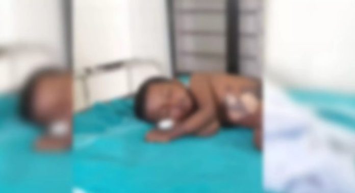 മൂന്നുവയസുകാരന്റെ ദേഹത്ത് തിളച്ച ചായ ഒഴിച്ച് പൊള്ളിച്ചതായി പരാതി മൂന്നുവയസുകാരന്റെ ദേഹത്ത് തിളച്ച ചായ ഒഴിച്ച് പൊള്ളിച്ചതായി പരാതി