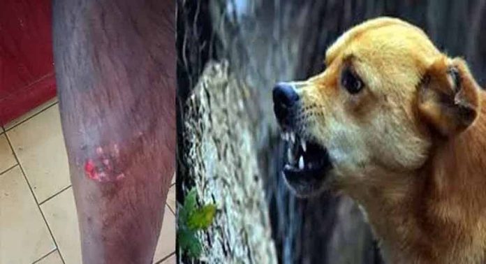തെരുവ് നായ ആക്രമണം : മല്ലപ്പുഴശ്ശേരി, പരപ്പുഴ, പൊന്നുംതോട്ടം ഭാഗങ്ങളില് മൂന്ന് പേര്ക്ക് കടിയേറ്റു തെരുവ് നായ ആക്രമണം : മല്ലപ്പുഴശ്ശേരി, പരപ്പുഴ, പൊന്നുംതോട്ടം ഭാഗങ്ങളില് മൂന്ന് പേര്ക്ക് കടിയേറ്റു