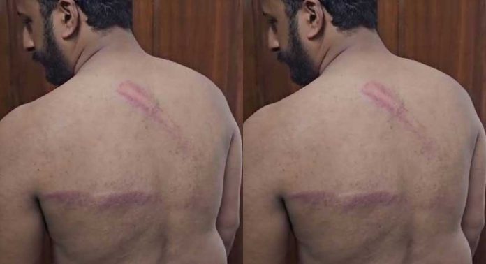 നീറ്റ് പരീക്ഷാ ചോദ്യ പേപ്പർ ചോർച്ചയിൽ പ്രതിഷേധം ; ലാത്തിച്ചാർജിൽ രാഹുൽ മാങ്കൂട്ടത്തിലിന് പരുക്ക് നീറ്റ് പരീക്ഷാ ചോദ്യ പേപ്പർ ചോർച്ചയിൽ പ്രതിഷേധം ; ലാത്തിച്ചാർജിൽ രാഹുൽ മാങ്കൂട്ടത്തിലിന് പരുക്ക്
