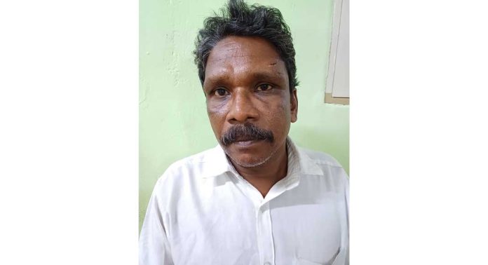 മകളുടെ കാലിന് കമ്പിവടിക്കടിച്ച് ഗുരുതര പരിക്കേൽപിച്ച പിതാവ് അറസ്റ്റിൽ മകളുടെ കാലിന് കമ്പിവടിക്കടിച്ച് ഗുരുതര പരിക്കേൽപിച്ച പിതാവ് അറസ്റ്റിൽ