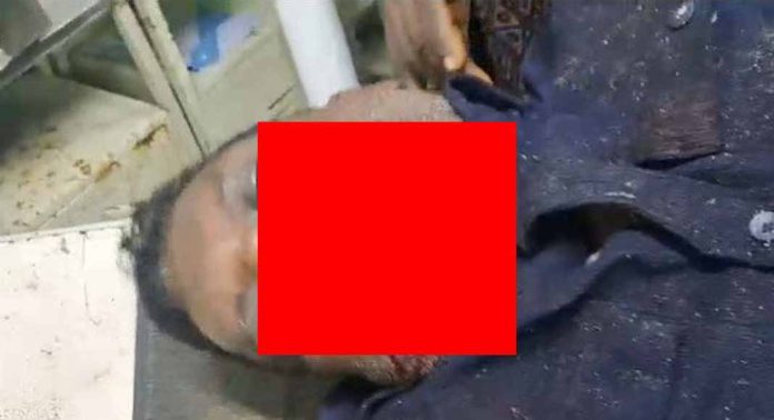 കല്ലേലിയില് റോഡ് കട്ടിംഗില് വീണ് ബൈക്ക് യാത്രികന് പരിക്ക് കല്ലേലിയില് റോഡ് കട്ടിംഗില് വീണ് ബൈക്ക് യാത്രികന് പരിക്ക്