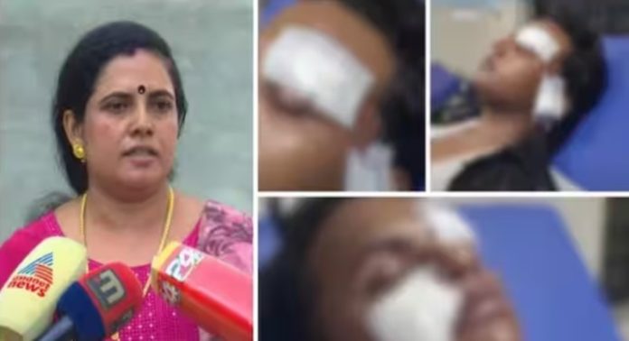 മൂലങ്കാവ് സ്കൂളില് വിദ്യാര്ത്ഥിക്ക് മർദനം : മകന് പരിക്കുണ്ട് ; കേസുമായി മുന്നോട്ട് പോകുമെന്ന് അമ്മ സ്മിത മൂലങ്കാവ് സ്കൂളില് വിദ്യാര്ത്ഥിക്ക് മർദനം : മകന് പരിക്കുണ്ട് ; കേസുമായി മുന്നോട്ട് പോകുമെന്ന് അമ്മ സ്മിത