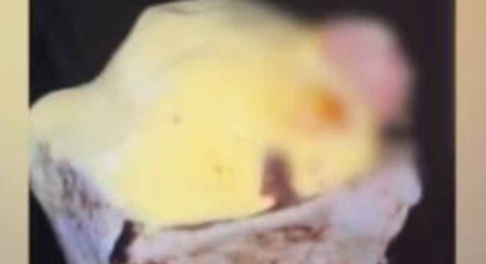 മുംബൈയിൽ ഐസ്ക്രീമിൽ വിരൽ കണ്ടെത്തിയ സംഭവം : കമ്പനിക്കെതിരെ കേസെടുത്തു മുംബൈയിൽ ഐസ്ക്രീമിൽ വിരൽ കണ്ടെത്തിയ സംഭവം : കമ്പനിക്കെതിരെ കേസെടുത്തു