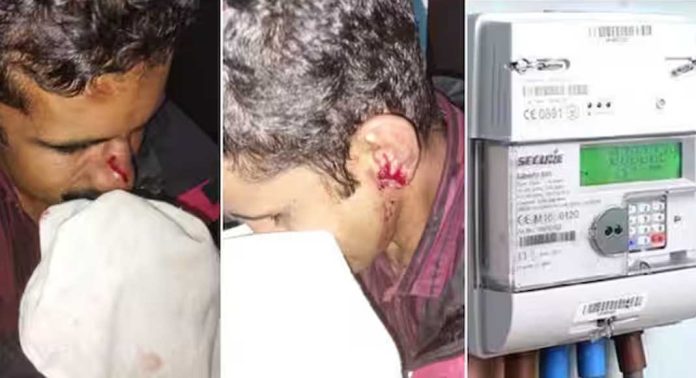നല്ലോംപുഴയിൽ കേടായ മീറ്റർ മാറ്റി സ്ഥാപിക്കുന്നതിലെ തർക്കത്തെ തുടർന്ന് കെഎസ്ഇബി ജീവനക്കാരെ വാഹനമിടിപ്പിച്ചതായി പരാതി നല്ലോംപുഴയിൽ കേടായ മീറ്റർ മാറ്റി സ്ഥാപിക്കുന്നതിലെ തർക്കത്തെ തുടർന്ന് കെഎസ്ഇബി ജീവനക്കാരെ വാഹനമിടിപ്പിച്ചതായി പരാതി