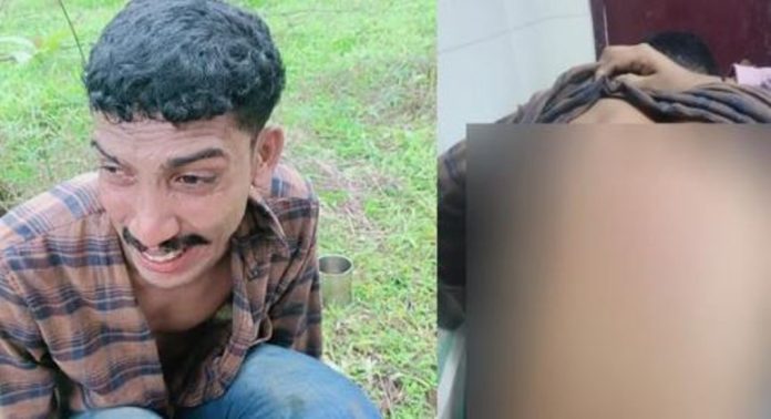ഇലക്ട്രിക് സ്കൂട്ടർ ചാര്ജ് ചെയ്യാൻ വീട്ടിൽ കയറി ; ഭിന്നശേഷിക്കാരനെ ക്രൂരമായി മർദിച്ചു ഇലക്ട്രിക് സ്കൂട്ടർ ചാര്ജ് ചെയ്യാൻ വീട്ടിൽ കയറി ; ഭിന്നശേഷിക്കാരനെ ക്രൂരമായി മർദിച്ചു 