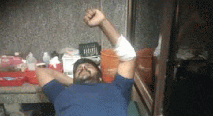 കാട്ടുപന്നി ഇടിച്ച് ബൈക്ക് യാത്രക്കാരന് പരിക്ക് കാട്ടുപന്നി ഇടിച്ച് ബൈക്ക് യാത്രക്കാരന് പരിക്ക്