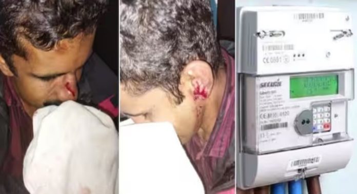 ജീപ്പിടിച്ച് വീഴ്ത്തി, ജാക്കി കൊണ്ട് തലക്കടിച്ചു ; രക്ഷപ്പെട്ടത് ഭാഗ്യം ; ദുരന്തം വിവരിച്ച് കെഎസ്ഇബി ജീവനക്കാരൻ ജീപ്പിടിച്ച് വീഴ്ത്തി, ജാക്കി കൊണ്ട് തലക്കടിച്ചു ; രക്ഷപ്പെട്ടത് ഭാഗ്യം ; ദുരന്തം വിവരിച്ച് കെഎസ്ഇബി ജീവനക്കാരൻ