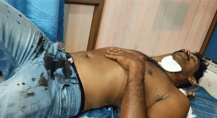 പൊട്ടിവീണ വൈദ്യുത കമ്പി കഴുത്തില് കുടുങ്ങി ബൈക്ക് യാത്രക്കാരന് പരിക്ക് പൊട്ടിവീണ വൈദ്യുത കമ്പി കഴുത്തില് കുടുങ്ങി ബൈക്ക് യാത്രക്കാരന് പരിക്ക്