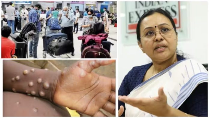 എംപോക്സ്: ജാഗ്രത പാലിക്കണമെന്ന് മന്ത്രി വീണാ ജോര്ജ് എംപോക്സ്: ജാഗ്രത പാലിക്കണമെന്ന് മന്ത്രി വീണാ ജോര്ജ്