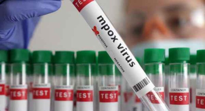 ഇന്ത്യയിൽ എംപോക്സ് ലക്ഷണങ്ങളോടെ ഒരാൾ നിരീക്ഷണത്തിൽ ; സാമ്പിൾ പരിശോധനക്കയച്ചു ഇന്ത്യയിൽ എംപോക്സ് ലക്ഷണങ്ങളോടെ ഒരാൾ നിരീക്ഷണത്തിൽ ; സാമ്പിൾ പരിശോധനക്കയച്ചു