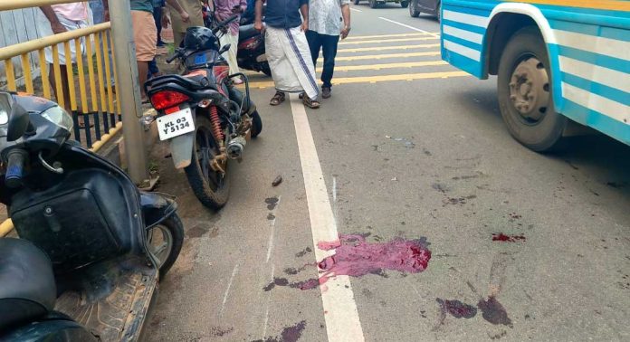 കോന്നി മാമൂട്ടിൽ നിയന്ത്രണം വിട്ട സ്കൂട്ടർ സുരക്ഷാ വേലിയിൽ ഇടിച്ച് യാത്രക്കാരന് ഗുരുതര പരിക്ക് കോന്നി മാമൂട്ടിൽ നിയന്ത്രണം വിട്ട സ്കൂട്ടർ സുരക്ഷാ വേലിയിൽ ഇടിച്ച് യാത്രക്കാരന് ഗുരുതര പരിക്ക്
