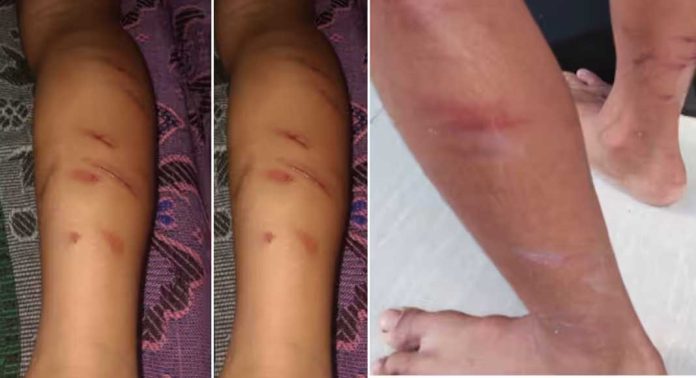 തൃശൂരില് അഞ്ച് വയസുകാരന് ക്ലാസ് ടീച്ചറുടെ ക്രൂര മര്ദനം തൃശൂരില് അഞ്ച് വയസുകാരന് ക്ലാസ് ടീച്ചറുടെ ക്രൂര മര്ദനം