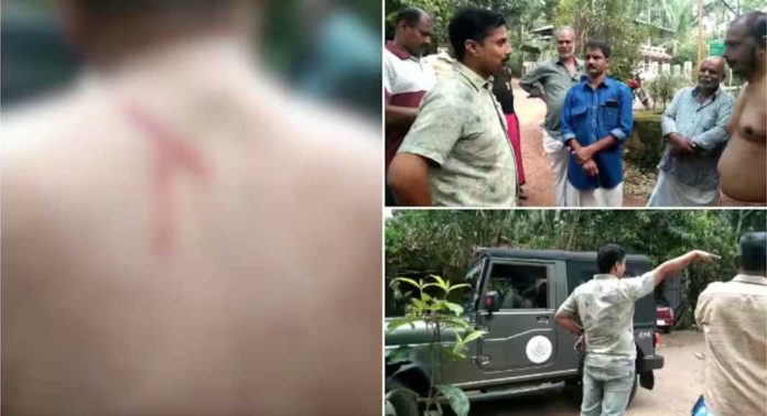 കൊല്ലം ചോഴിയക്കോട് മലയണ്ണാന്റെ ആക്രമണത്തിൽ യുവാവിന് പരിക്ക് കൊല്ലം ചോഴിയക്കോട് മലയണ്ണാന്റെ ആക്രമണത്തിൽ യുവാവിന് പരിക്ക്