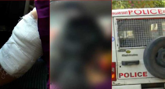 ഓട്ടോ മറ്റൊരു വഴിയിലൂടെ പോയി, നിര്ത്താൻ പറഞ്ഞിട്ടും കേട്ടില്ല, പുറത്തേക്ക് ചാടിയ പെണ്കുട്ടിക്ക് പരിക്ക് ഓട്ടോ മറ്റൊരു വഴിയിലൂടെ പോയി, നിര്ത്താൻ പറഞ്ഞിട്ടും കേട്ടില്ല, പുറത്തേക്ക് ചാടിയ പെണ്കുട്ടിക്ക് പരിക്ക്