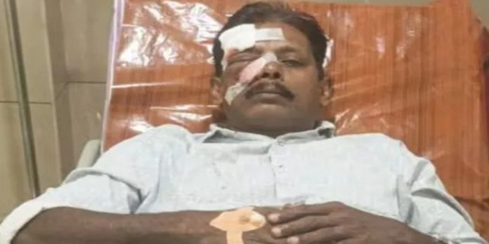 തെങ്ങിൻമുകളിൽ നിന്ന കുരങ്ങൻ കരിക്കെറിഞ്ഞു ; കർഷകന് ഗുരുതര പരിക്ക് തെങ്ങിൻമുകളിൽ നിന്ന കുരങ്ങൻ കരിക്കെറിഞ്ഞു ; കർഷകന് ഗുരുതര പരിക്ക്
