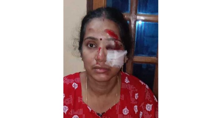 നായകളുടെ കൂട്ടം ഇരുചക്ര വാഹനത്തിനു മുന്നിൽ ചാടി ; യാത്രികയ്ക്ക് ഗുരുതര പരുക്ക് നായകളുടെ കൂട്ടം ഇരുചക്ര വാഹനത്തിനു മുന്നിൽ ചാടി ; യാത്രികയ്ക്ക് ഗുരുതര പരുക്ക്
