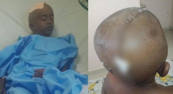 തമിഴ്നാട്ടിൽ ദളിത് വിദ്യാർഥിയുടെ തല അധ്യാപകൻ അടിച്ചുപൊട്ടിച്ചു തമിഴ്നാട്ടിൽ ദളിത് വിദ്യാർഥിയുടെ തല അധ്യാപകൻ അടിച്ചുപൊട്ടിച്ചു