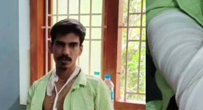 സ്ലാബില്ലാത്ത ഓടയിൽ വീണ് ടാക്സി ഡ്രൈവറുടെ കൈയൊടിഞ്ഞു സ്ലാബില്ലാത്ത ഓടയിൽ വീണ് ടാക്സി ഡ്രൈവറുടെ കൈയൊടിഞ്ഞു