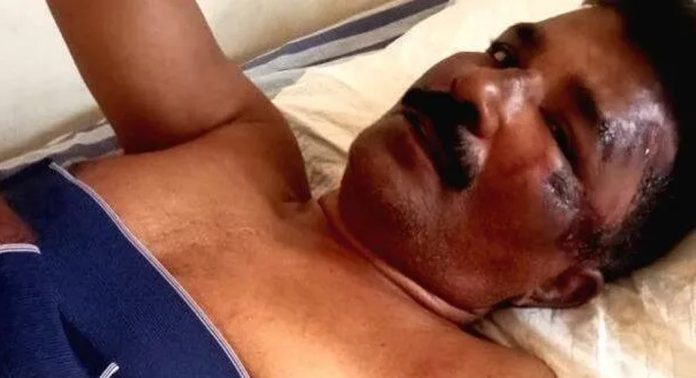കുളനടയില് കാട്ടുപന്നി ആക്രമണത്തില് ഓട്ടോറിക്ഷ ഡ്രൈവർക്കും യാത്രക്കാരനും ഗുരുതരമായി പരിക്കേറ്റു കുളനടയില് കാട്ടുപന്നി ആക്രമണത്തില് ഓട്ടോറിക്ഷ ഡ്രൈവർക്കും യാത്രക്കാരനും ഗുരുതരമായി പരിക്കേറ്റു