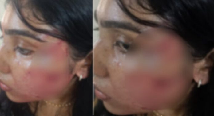 അഭിഭാഷകയ്ക്ക് ക്രൂരമര്ദനം ; മുതിര്ന്ന അഭിഭാഷകനെ സസ്പെന്ഡ് ചെയ്ത് ബാര് അസോസിയേഷൻ അഭിഭാഷകയ്ക്ക് ക്രൂരമര്ദനം ; മുതിര്ന്ന അഭിഭാഷകനെ സസ്പെന്ഡ് ചെയ്ത് ബാര് അസോസിയേഷൻ