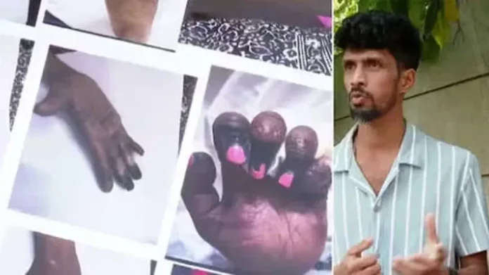 കൊഴുപ്പ് മാറ്റൽ ശസ്ത്രക്രിയയിലെ പിഴവ് ; ഡിജിപിക്ക് പരാതി നൽകി യുവതിയുടെ കുടുംബം കൊഴുപ്പ് മാറ്റൽ ശസ്ത്രക്രിയയിലെ പിഴവ് ; ഡിജിപിക്ക് പരാതി നൽകി യുവതിയുടെ കുടുംബം