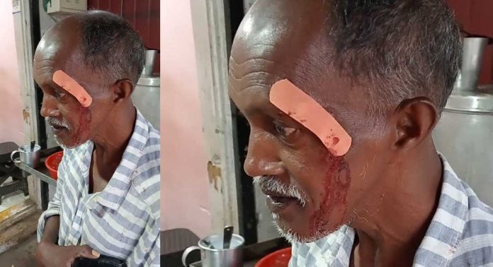 കാട്ടാനയെ കണ്ട് ഭയന്ന് ഓടി വീണ കാൽനടയാത്രികന് പരിക്ക് കാട്ടാനയെ കണ്ട് ഭയന്ന് ഓടി വീണ കാൽനടയാത്രികന് പരിക്ക്