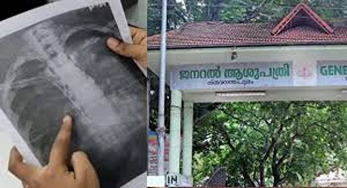 തിരുവനന്തപുരം ജനറൽ ആശുപത്രിയിലെ ചികിത്സ പിഴവിൽ ആശുപത്രി രേഖകൾ ആവശ്യപ്പെട്ട് പോലീസ് തിരുവനന്തപുരം ജനറൽ ആശുപത്രിയിലെ ചികിത്സ പിഴവിൽ ആശുപത്രി രേഖകൾ ആവശ്യപ്പെട്ട് പോലീസ്