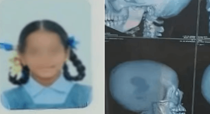 ആറാം ക്ലാസുകാരിയെ ക്രൂരമായി മര്ദിച്ച് അധ്യാപിക ; തലയോട്ടിക്ക് പരിക്ക് ആറാം ക്ലാസുകാരിയെ ക്രൂരമായി മര്ദിച്ച് അധ്യാപിക ; തലയോട്ടിക്ക് പരിക്ക്