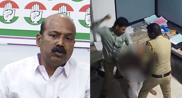 ഹോട്ടൽ ജീവനക്കാരെ മർദിച്ച പീച്ചി പോലീസ് സ്റ്റേഷനിലേയ്ക്ക് ഇന്ന് കോൺഗ്രസ് മാർച്ച് നടത്തും ഹോട്ടൽ ജീവനക്കാരെ മർദിച്ച പീച്ചി പോലീസ് സ്റ്റേഷനിലേയ്ക്ക് ഇന്ന് കോൺഗ്രസ് മാർച്ച് നടത്തും