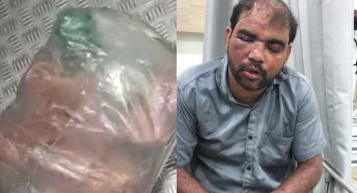 ഓടുന്ന ട്രെയിനിൽ നിന്ന് കച്ചവടക്കാരൻ എടുത്തു ചാടി ; ഗുരുതര പരിക്കുകളോടെ ആശുപത്രിയിൽ പ്രവേശിപ്പിച്ചു ഓടുന്ന ട്രെയിനിൽ നിന്ന് കച്ചവടക്കാരൻ എടുത്തു ചാടി ; ഗുരുതര പരിക്കുകളോടെ ആശുപത്രിയിൽ പ്രവേശിപ്പിച്ചു