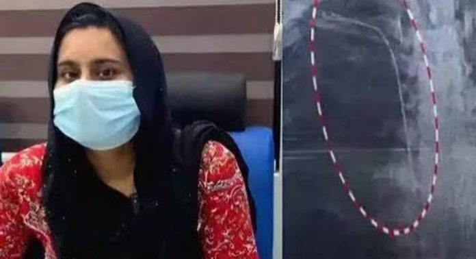 ഗൈഡ് വയര് നെഞ്ചില് കുടുങ്ങിയ സുമയ്യക്ക് നിര്ണായക ശസ്ത്രക്രിയ ; ഗൈഡ് വയര് പുറത്തെടുക്കാൻ ശ്രമം ഗൈഡ് വയര് നെഞ്ചില് കുടുങ്ങിയ സുമയ്യക്ക് നിര്ണായക ശസ്ത്രക്രിയ ; ഗൈഡ് വയര് പുറത്തെടുക്കാൻ ശ്രമം