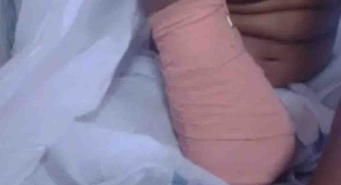 ഒമ്പത് വയസുകാരിയുടെ കൈ മുറിച്ചുമാറ്റിയ സംഭവം ; ചികിത്സാ പിഴവ് സമ്മതിച്ച് പാലക്കാട് ജില്ലാ ആശുപത്രി ഒമ്പത് വയസുകാരിയുടെ കൈ മുറിച്ചുമാറ്റിയ സംഭവം ; ചികിത്സാ പിഴവ് സമ്മതിച്ച് പാലക്കാട് ജില്ലാ ആശുപത്രി