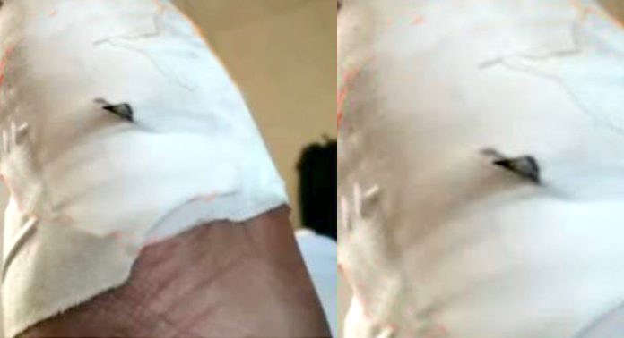 ശബരിമല പമ്പാ ആശുപത്രിയില് സർജിക്കൽ ബ്ലേഡ് മുറിവിനുള്ളിൽ വെച്ച് കെട്ടി : പരാതിയുമായി നെടുമ്പാശേരി സ്വദേശിനി ശബരിമല പമ്പാ ആശുപത്രിയില് സർജിക്കൽ ബ്ലേഡ് മുറിവിനുള്ളിൽ വെച്ച് കെട്ടി : പരാതിയുമായി നെടുമ്പാശേരി സ്വദേശിനി