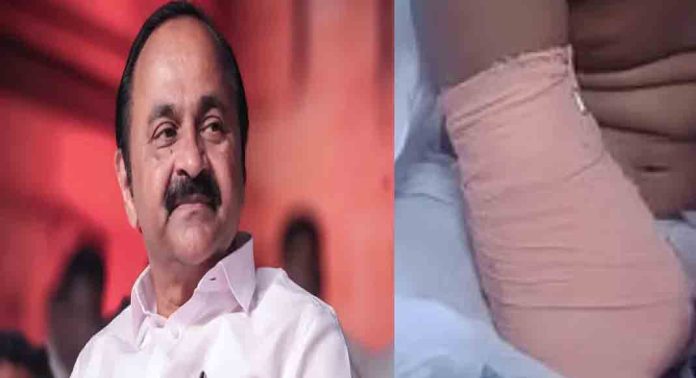 ചികിത്സാ പിഴവ് മൂലം കൈമുറിച്ചുമാറ്റേണ്ടി വന്ന വിനോദിനിയ്ക്ക് വീണ്ടും വി ഡി സതീശന്റെ സഹായഹസ്തം ചികിത്സാ പിഴവ് മൂലം കൈമുറിച്ചുമാറ്റേണ്ടി വന്ന വിനോദിനിയ്ക്ക് വീണ്ടും വി ഡി സതീശന്റെ സഹായഹസ്തം