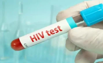 hiv