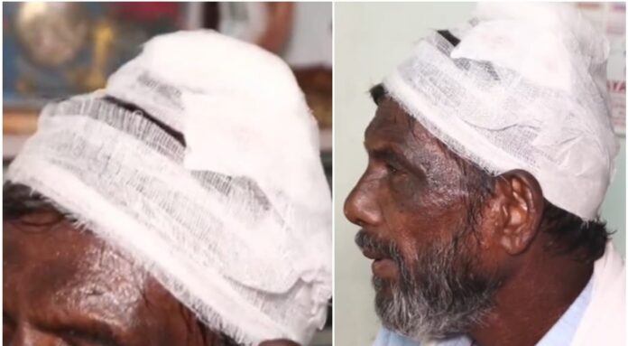 ഇറങ്ങാൻ വൈകിയതിന് കമ്പികൊണ്ട് വയോധികന്റെ തലയ്ക്കടിച്ചു ; കെഎസ്ആർടിസി ഡ്രൈവർക്കെതിരെ കേസ് ഇറങ്ങാൻ വൈകിയതിന് കമ്പികൊണ്ട് വയോധികന്റെ തലയ്ക്കടിച്ചു ; കെഎസ്ആർടിസി ഡ്രൈവർക്കെതിരെ കേസ്