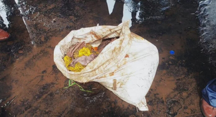 കല്ലിശ്ശേരി റെയിൽവേ പാലത്തിന് താഴെ പമ്പയാറ്റില് ചാക്കിൽ കെട്ടിയ നിലയിൽ അസ്ഥികൂടം കണ്ടെത്തി കല്ലിശ്ശേരി റെയിൽവേ പാലത്തിന് താഴെ പമ്പയാറ്റില് ചാക്കിൽ കെട്ടിയ നിലയിൽ അസ്ഥികൂടം കണ്ടെത്തി