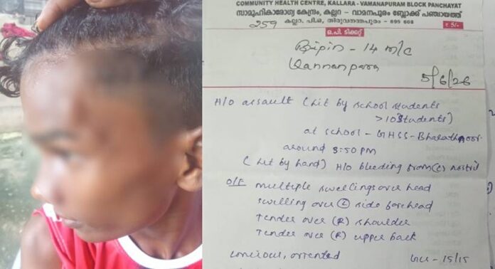തിരുവനന്തപുരം ഭരതന്നൂരിൽ സ്കൂൾ വിദ്യാർത്ഥിയെ മർദ്ദിച്ചതായി പരാതി തിരുവനന്തപുരം ഭരതന്നൂരിൽ സ്കൂൾ വിദ്യാർത്ഥിയെ മർദ്ദിച്ചതായി പരാതി
