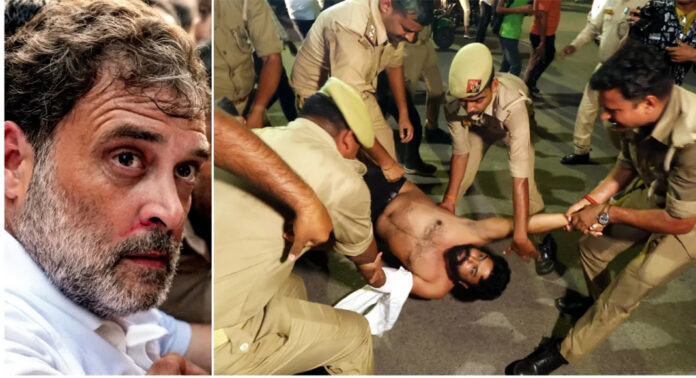 രാജ്യത്തെ പരീക്ഷ ക്രമക്കേടുകള്ക്കെതിരായ പ്രതിഷേധത്തിനിടെ പരിക്കേറ്റ വിദ്യാര്ഥിക്കൊപ്പം വാര്ത്താ സമ്മേളനം നടത്തി രാഹുല് ഗാന്ധി രാജ്യത്തെ പരീക്ഷ ക്രമക്കേടുകള്ക്കെതിരായ പ്രതിഷേധത്തിനിടെ പരിക്കേറ്റ വിദ്യാര്ഥിക്കൊപ്പം വാര്ത്താ സമ്മേളനം നടത്തി രാഹുല് ഗാന്ധി