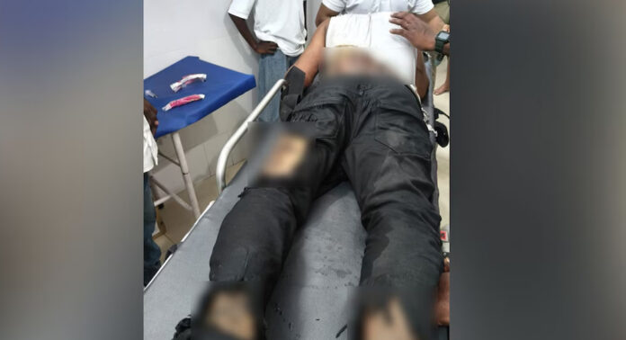 ബാറിലെ സംഘർഷത്തിനു പിന്നാലെ പെട്രോൾ ദേഹത്തൊഴിച്ച് തീകൊളുത്തി ; നാലുപേർക്ക് പൊള്ളലേറ്റു, നില ഗുരുതരം ബാറിലെ സംഘർഷത്തിനു പിന്നാലെ പെട്രോൾ ദേഹത്തൊഴിച്ച് തീകൊളുത്തി ; നാലുപേർക്ക് പൊള്ളലേറ്റു, നില ഗുരുതരം